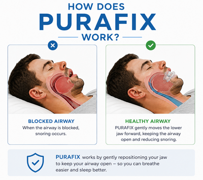 Purafix Anti-Snoring Mouthpiece