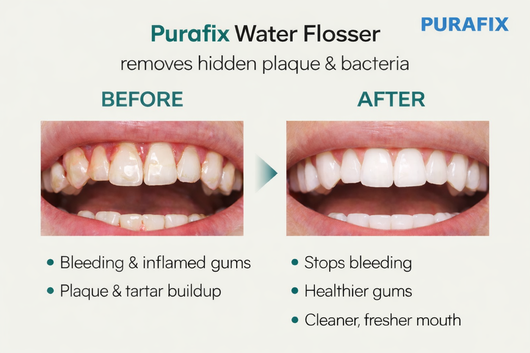 Purafix Water Flosser
